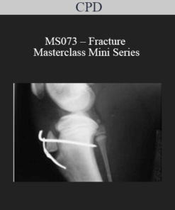 CPD - MS073 – Fracture Masterclass Mini Series