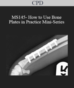CPD - MS145- How to Use Bone Plates in Practice Mini-Series